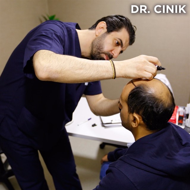 زراعة الشعر فى مصر - Posts - Facebook