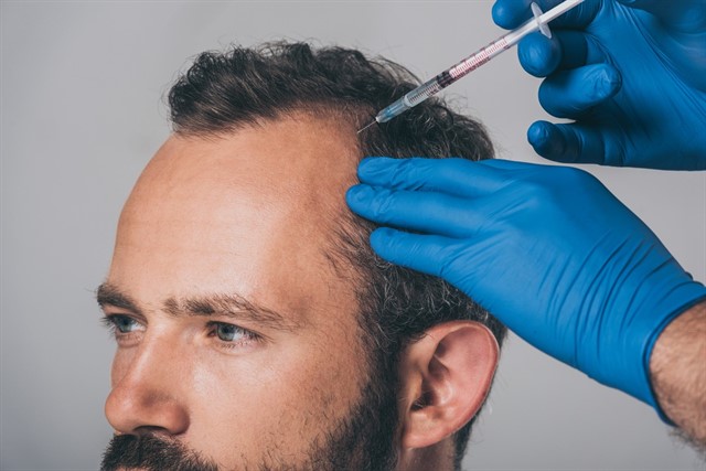 ماهو افضل مركز لزراعة الشعر في تركيا 