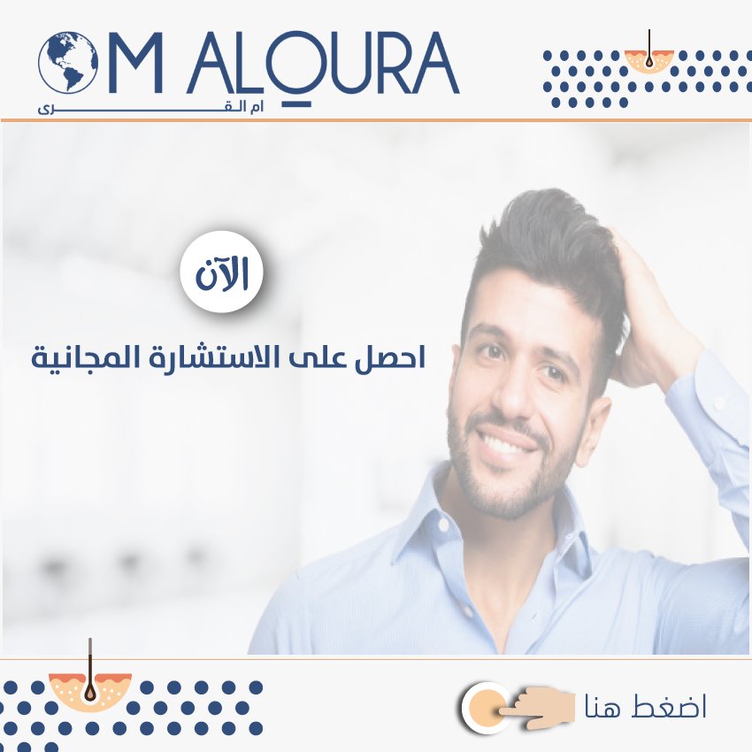افضل مراكز زراعة الشعر في تركيا